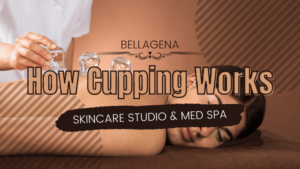 How Cupping Works | Bellagena Med Spa